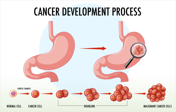 Cancer Development Process